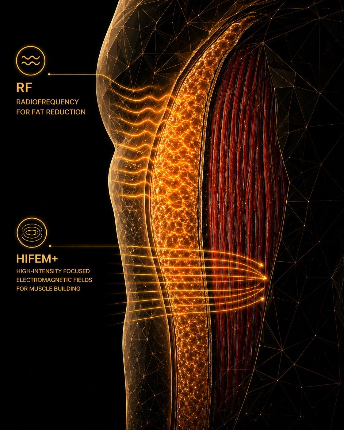 Anatomical cross-section showing HIFEM+ electromagnetic fields penetrating muscle and radiofrequency reducing subcutaneous fat