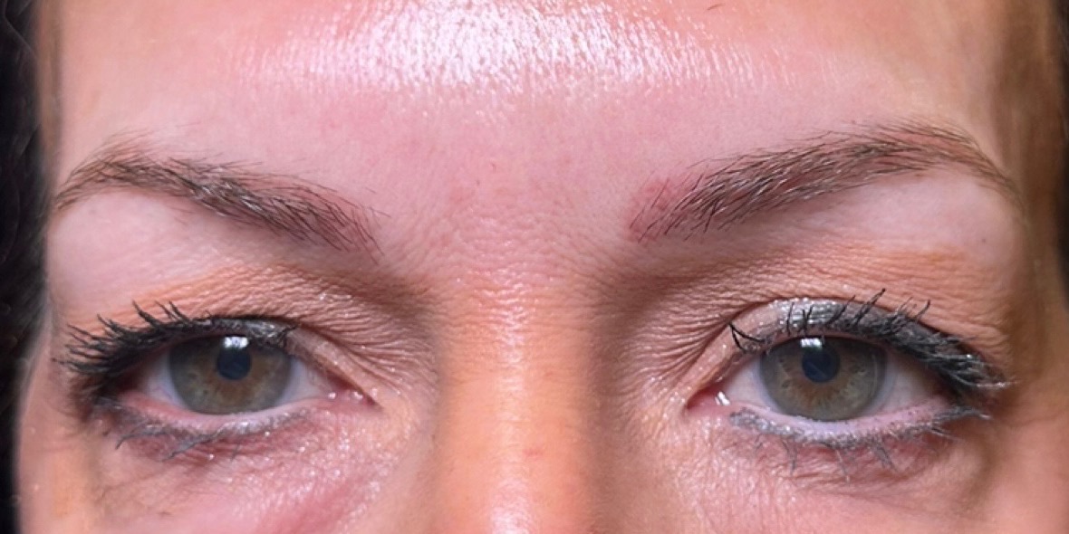 Microblading — before, at DK Aesthetics, Highland Park IL