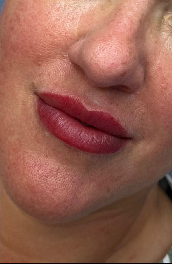 Lip Blushing — after result at DK Aesthetics, Highland Park IL